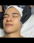 KrX Brightening Peel