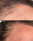 KrX Premium Meso Hair Solution - by Kin Aesthetics