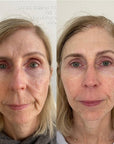 KrX Youthplex Face Lift Cream - by Kin Aesthetics
