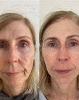 KrX Youthplex Face Lift Serum - by Kin Aesthetics