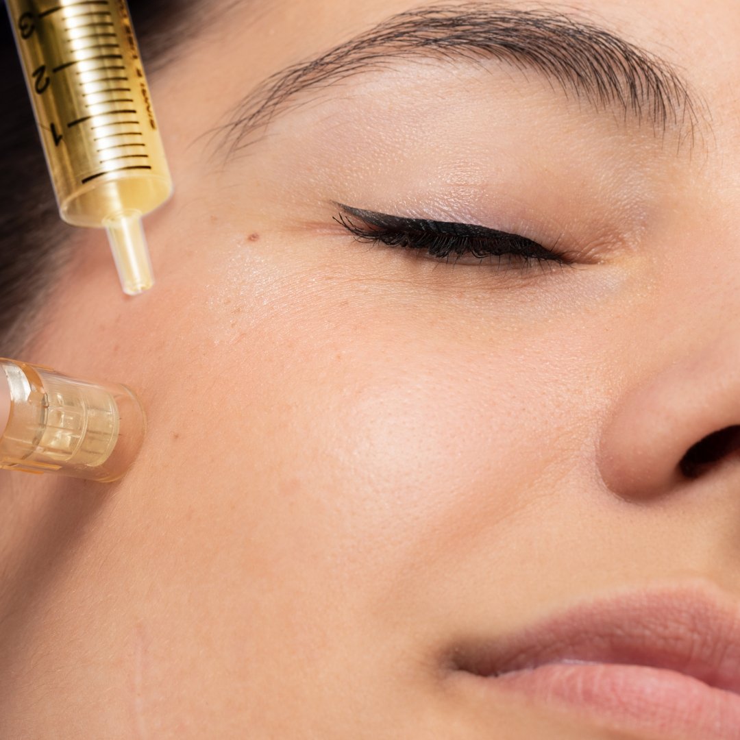 A Quick Guide: Nano Vs Micro-needling – By Kin Aesthetics