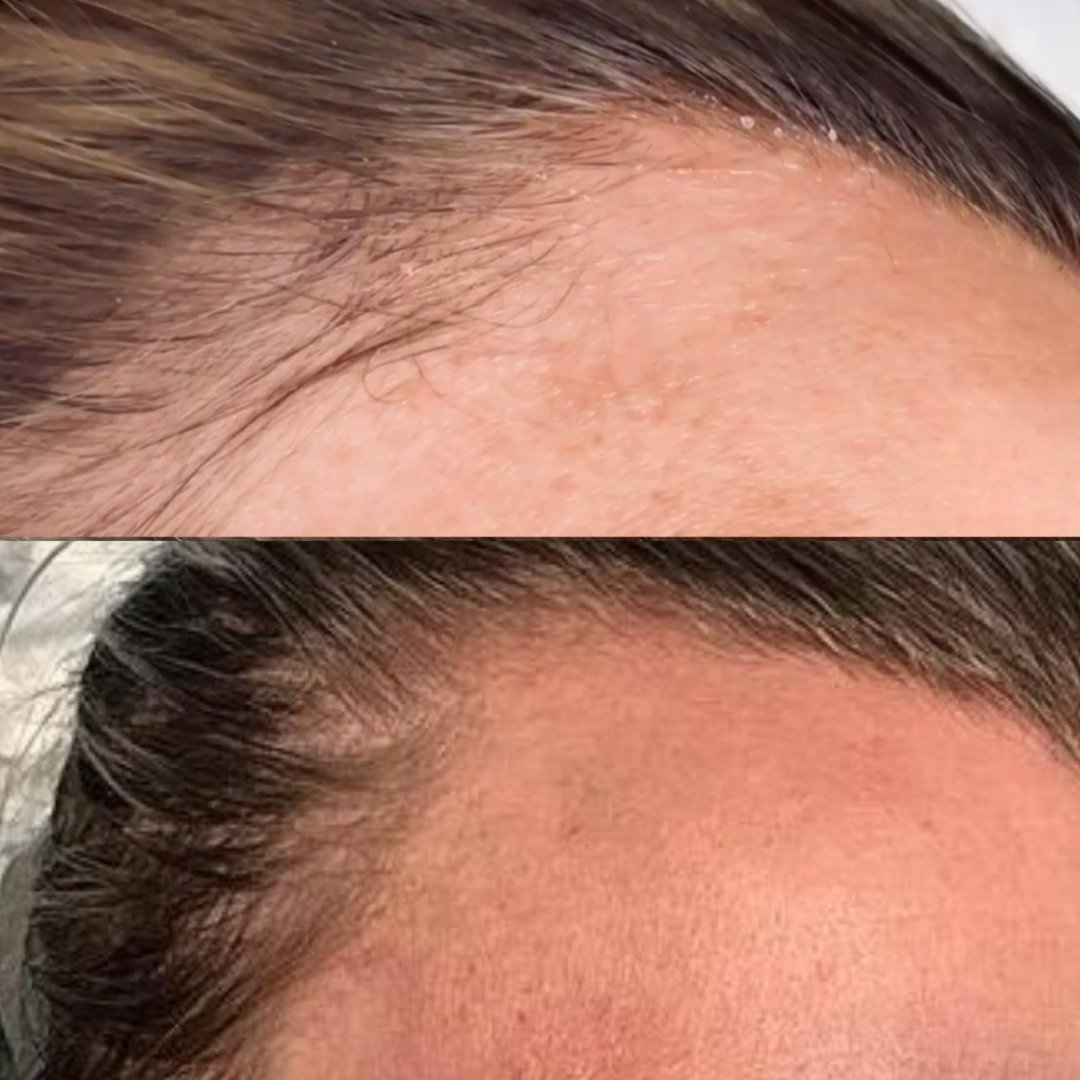 Scalp Care – by Kin Aesthetics